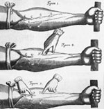 William Harvey - By his discovery of the circulation of the blood, Harvey revolutionized physiology which had been based on the assumptions about how materials flow through the blood vessels